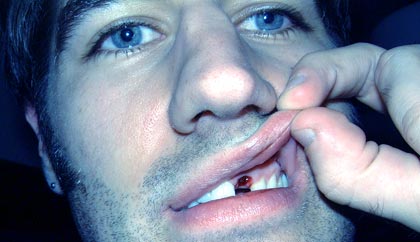 try not to mumble / as my teeth crumble